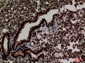 FOXP1 rabbit pAb Antibody
