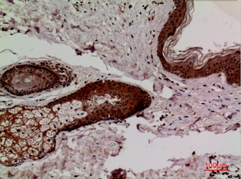 Keap-1 rabbit pAb Antibody