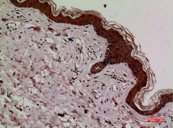 Keap-1 rabbit pAb Antibody