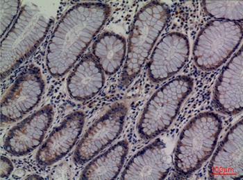 Lipocalin-1 rabbit pAb Antibody