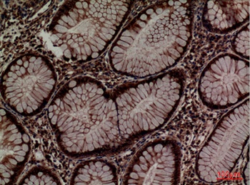ERp57 rabbit pAb Antibody
