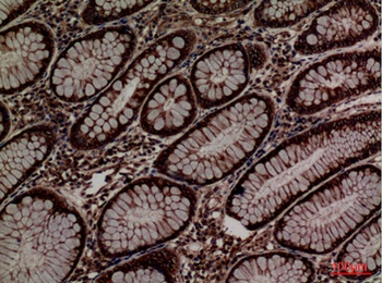 ERp57 rabbit pAb Antibody