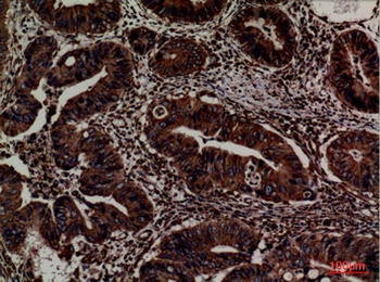 ERp57 rabbit pAb Antibody