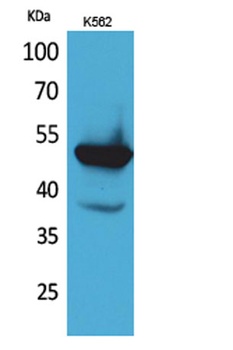 Protein C rabbit pAb Antibody