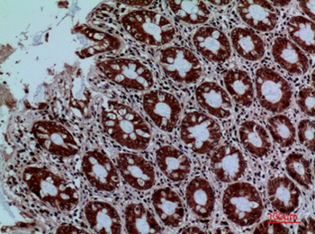 Protein C rabbit pAb Antibody
