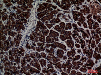 CD1E rabbit pAb Antibody