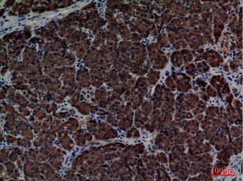 CD1E rabbit pAb Antibody