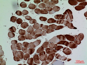 CD7 rabbit pAb Antibody