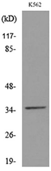 CD32-A rabbit pAb Antibody