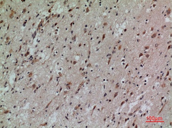 CD58 rabbit pAb Antibody