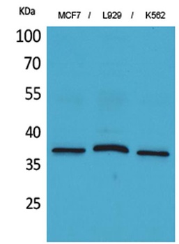 CD79b rabbit pAb Antibody