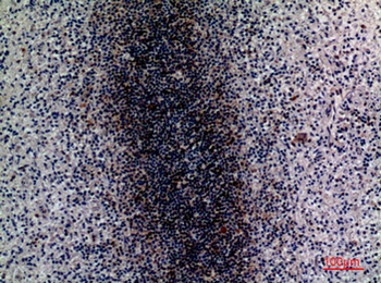 CD79b rabbit pAb Antibody