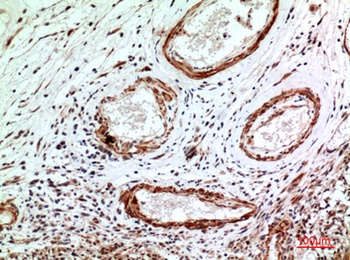IL-1RI rabbit pAb Antibody