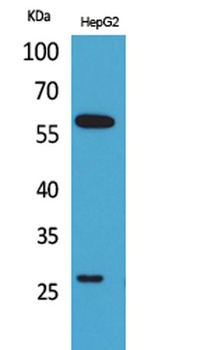 GGT1 rabbit pAb Antibody