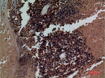 CD158z rabbit pAb Antibody