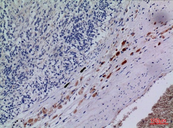 CXCR-3 rabbit pAb Antibody