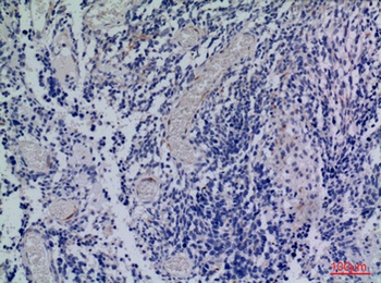 CXCR-3 rabbit pAb Antibody