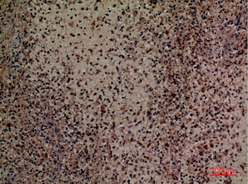 CD201 rabbit pAb Antibody