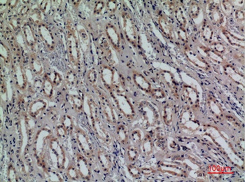 CD159a/c rabbit pAb Antibody