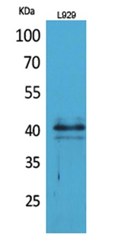CKR-4 rabbit pAb Antibody