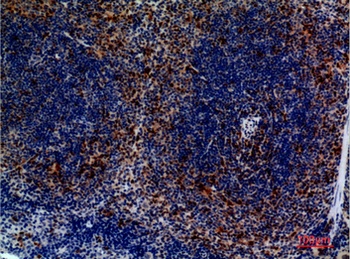 CKR-4 rabbit pAb Antibody