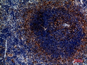 CKR-4 rabbit pAb Antibody