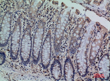 CDCP1 rabbit pAb Antibody