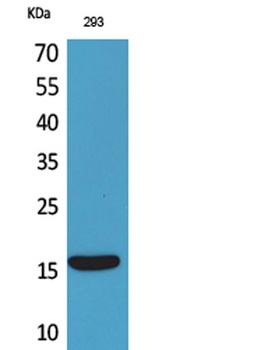 PSP rabbit pAb Antibody