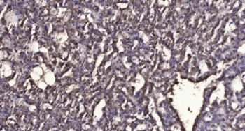 PSP rabbit pAb Antibody