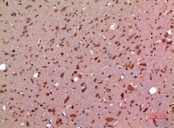 GDF-5 rabbit pAb Antibody
