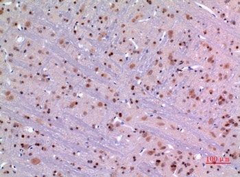 ARP rabbit pAb Antibody