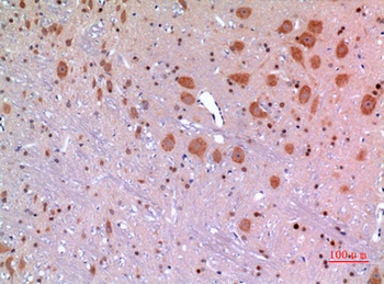 ARP rabbit pAb Antibody