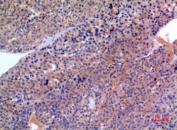 SCCA1/2 rabbit pAb Antibody