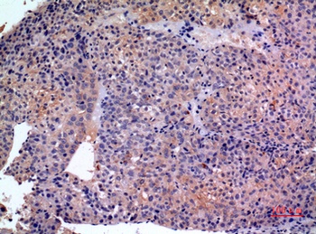 SCCA1/2 rabbit pAb Antibody