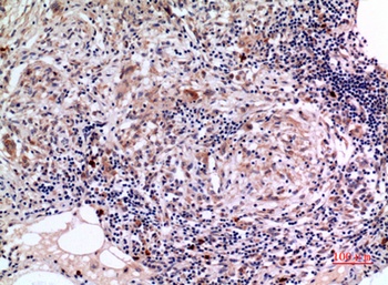 SCCA1/2 rabbit pAb Antibody