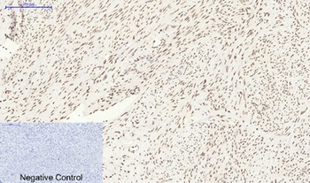 Bcl-6 rabbit pAb Antibody