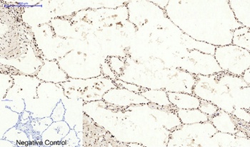Bcl-6 rabbit pAb Antibody