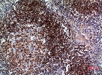 Pax-5 rabbit pAb Antibody