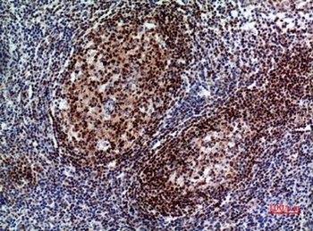Pax-5 rabbit pAb Antibody