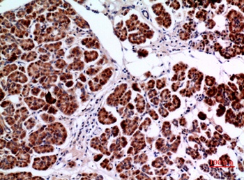 Amphiphysin II rabbit pAb Antibody