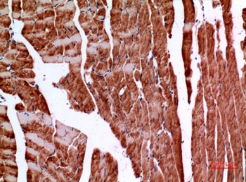 Amphiphysin II rabbit pAb Antibody