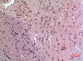 GDI-2 rabbit pAb Antibody