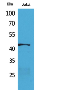 E2F-4 rabbit pAb Antibody