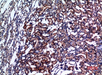 E2F-4 rabbit pAb Antibody