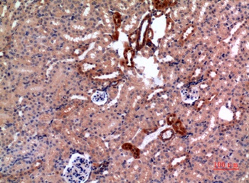E2F-4 rabbit pAb Antibody