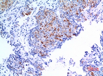 Keratin-pan rabbit pAb Antibody