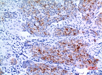 Keratin-pan rabbit pAb Antibody