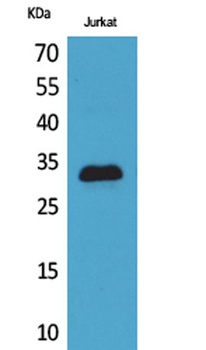 p57 rabbit pAb Antibody
