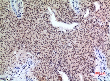 p57 rabbit pAb Antibody