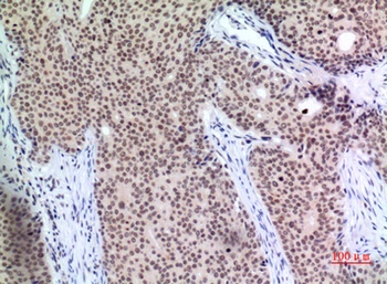 p57 rabbit pAb Antibody